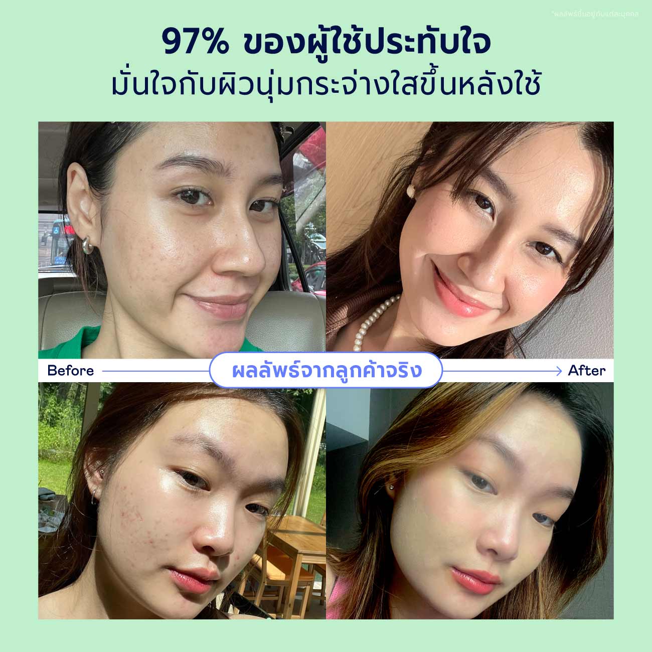 Green Forever Young Mask