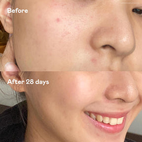 Complete Multi-Lift Trio