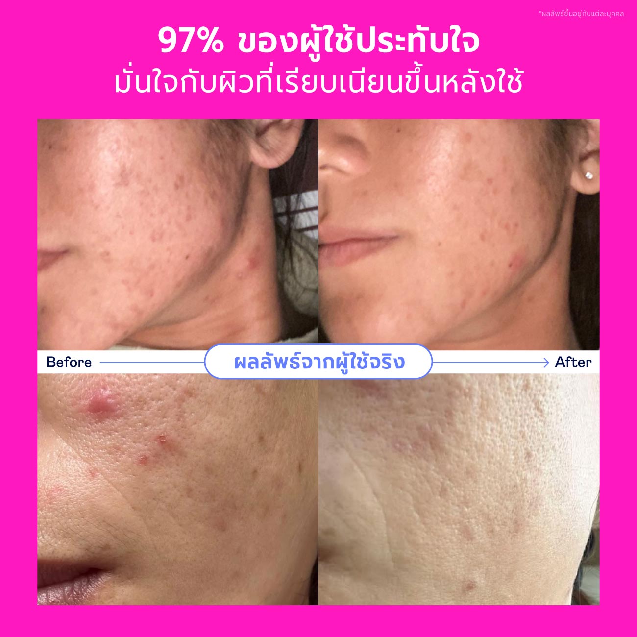 Songkran Skincare Set