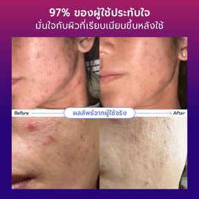 Skincare Promo Set